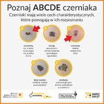 Ilustracja do artykułu ABCDE czerniak.png